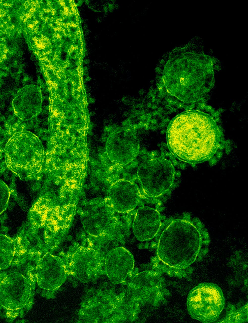 Spirit Chronicles: The Virus Encampment